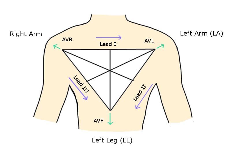 8 Figure 4: Einthoven s triangle is composed of the bipolar limb leads I-III in the coronal plane.