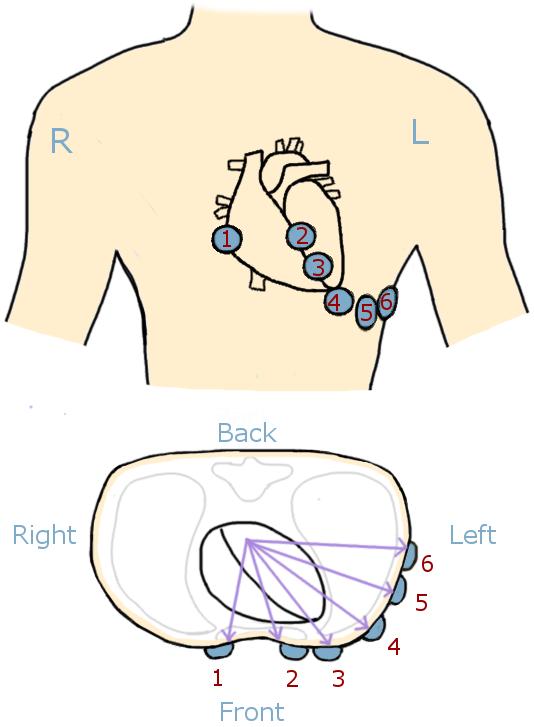 Directions of the leads are marked by arrows.