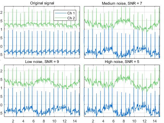 Figure 15: Noise was added in different levels to MITDB record 100.