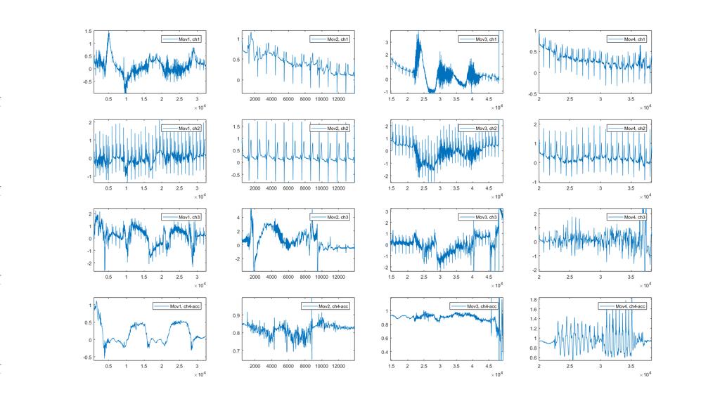 51 4.2.2 Effect of different movements on ECG signal Artifact levels were defined also by visual inspection for comparison with the correlation results.
