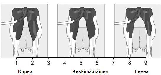 Erittäin irrallaan oleva kiinnittymisestä edestä annetaan pistearvo 1.