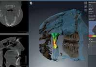 analysoida KKTT-kuvadataa 3D Endo on