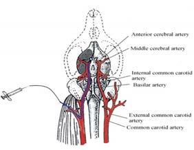24 Figure 7. Scheme of cell transplantation. The cells were infused from the ECA stump after sham or tmcao surgery.
