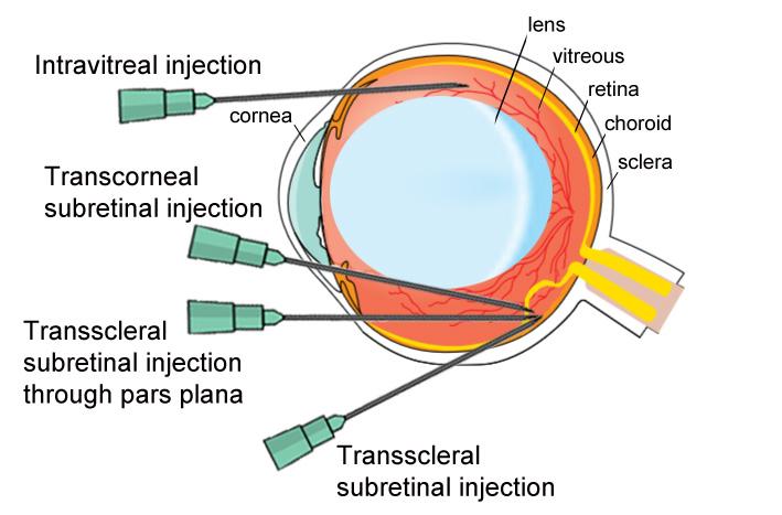 22 The eye possesses unique anatomical features that make it an excellent target for gene therapy (Solinís et al., 2015).