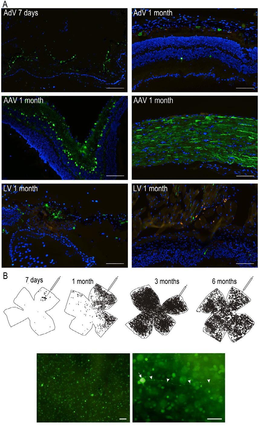 40 Figure 8. GFP expression in the eye after different viral vectors.