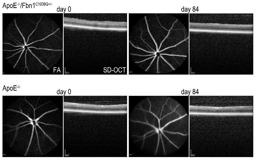 48 5.4 LACK OF RETINAL VASCULAR OCCLUSION AND NEOVASCULARIZATION IN MICE WITH VULNERABLE ATHEROSCLEROTIC PLAQUES (IV) Transgenic mice with an elastic fiber mutation in the fibrillin-1 (Fbn-1) gene