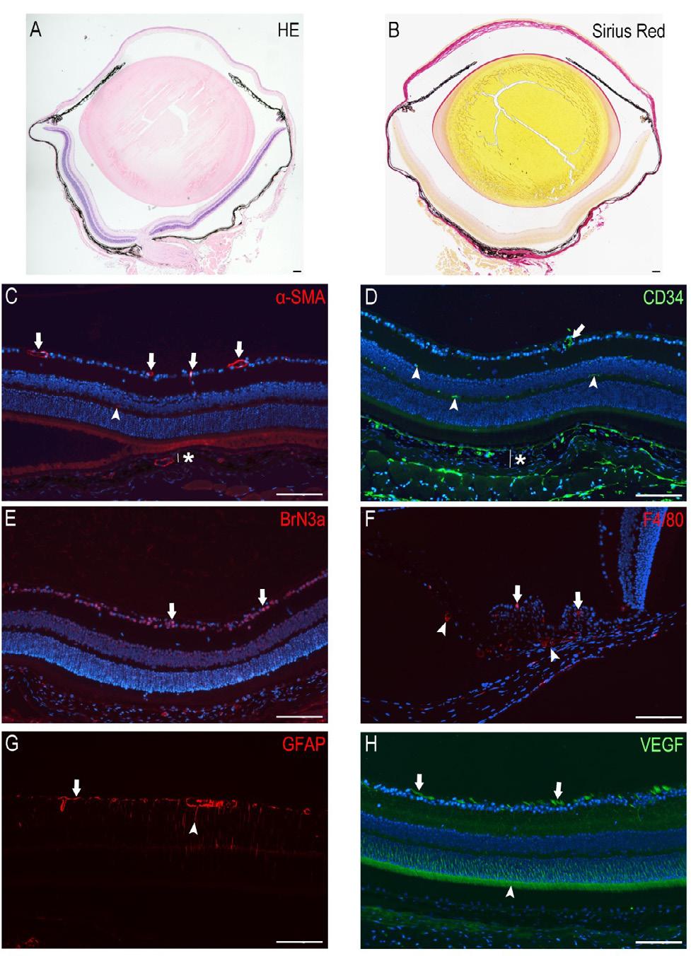49 Figure 15. Histology and immunohistochemistry of mice with fibrillin-1 mutation and apolipoprotein E deficiency (ApoE -/- Fbn1 C1039G+/- ).