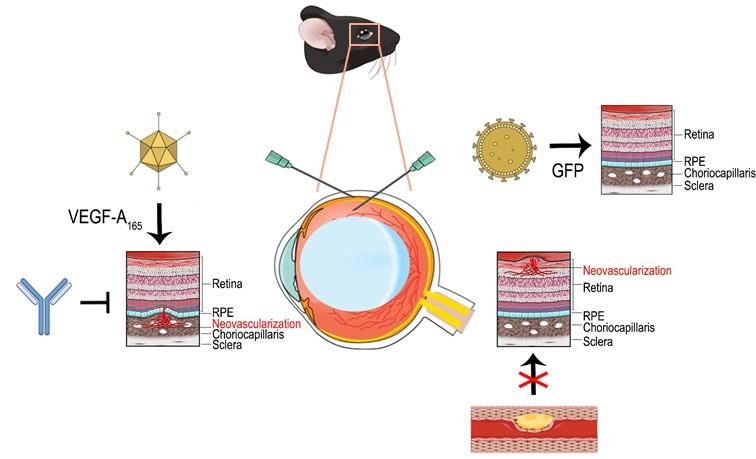 58 Additionally, a lentivirus mediated antibody-based anti-angiogenic gene therapy was created.