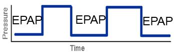 EPAP (Expiratory Positive Airway Pressure) Sovita intrinsic PEEPin kanssa sitä kompensoimaan: hengitystyö ja epäonnistuneet triggaukset Atelektaasin korjaaminen; ventilaatio-perfuusiosuhde ja
