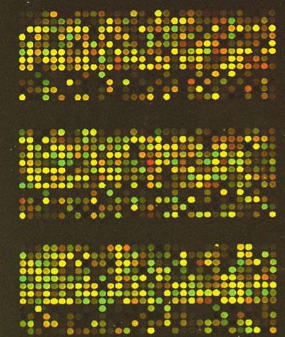 Expression Proteins &