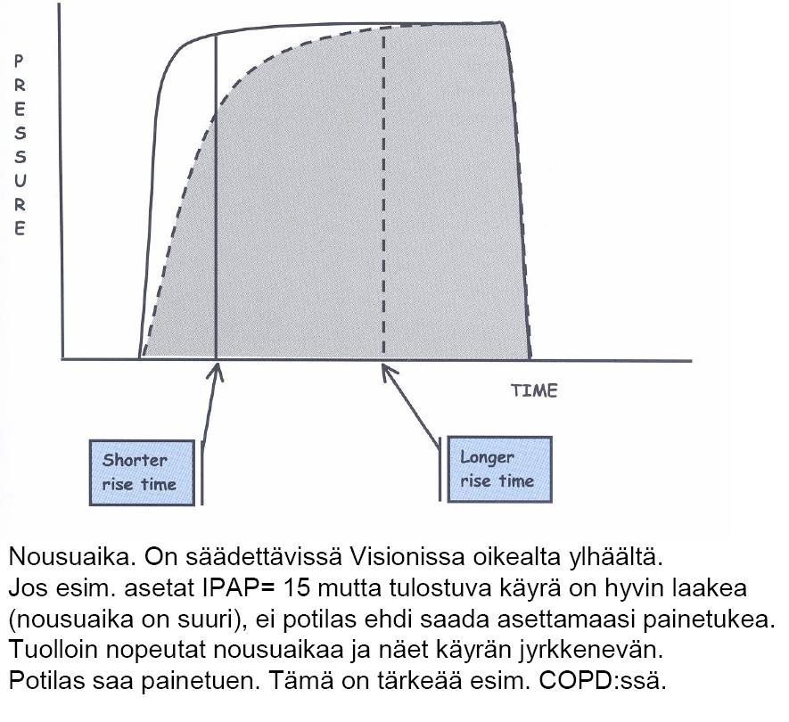 Rise time = painetuen nousuaika BiPaP Vision: 0,1 0,4 s Jos hf suuri, lyhennä Jos potilasta ahdistaa painetuki, pidennä Huom!