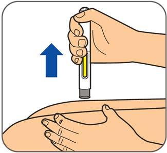 Vaihe 5: Paina esitäytetty kynä tukevasti pistoskohtaan injisoinnin aloittamiseksi. Laite naksahtaa, kun injisointi alkaa. Pidä esitäytettyä kynää painettuna edelleen tukevasti pistoskohtaan.