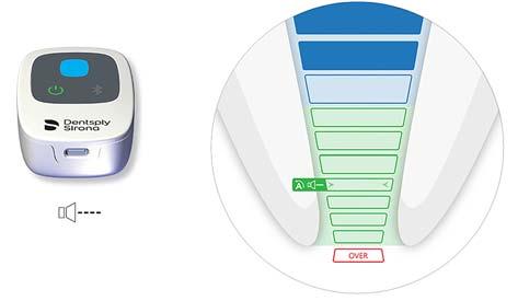 6.7.7 Työskentelypituuden määrittäminen Älä aloita hoitoa, jos akun lataustila on heikko. Juurihoitoviilan eteneminen ilmaistaan Propex IQ -juurikanavamittarin keskellä olevalla LED-merkkivalolla.