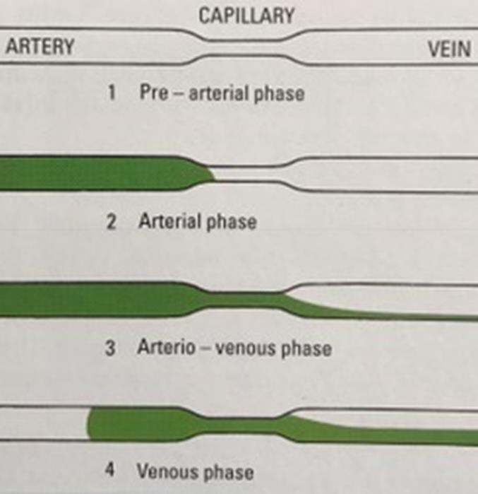 FAG 10s pre-arterial stage 10-12s retinal arterial stage 13s capillary transition stage 14-15s