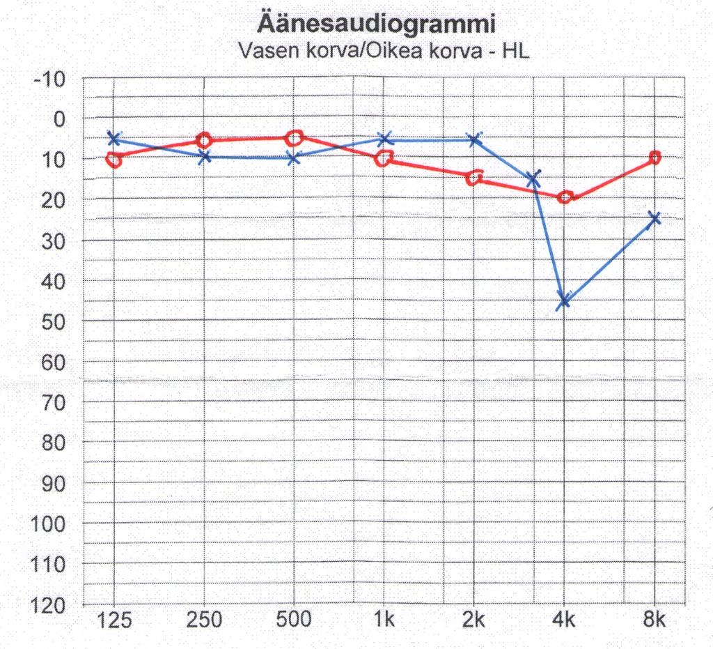 - Hirvikiväärillä harjoitellut - Sisäkorvaperäinen meluvamma, I / II lk - herkkyys