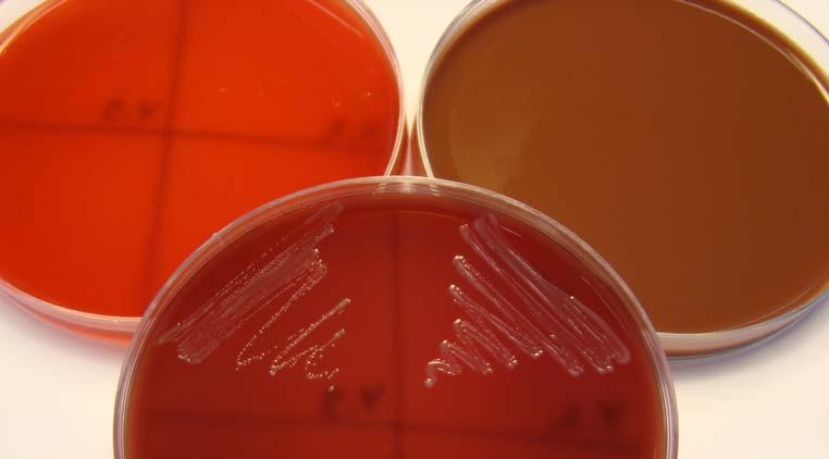 Näyte 4 / 2009. Bacteroides fragilis ja Peptostreptococcus anaerobius Aerotoleranssikoe 1.Verimalja aerobisesti 1 3 2 2.