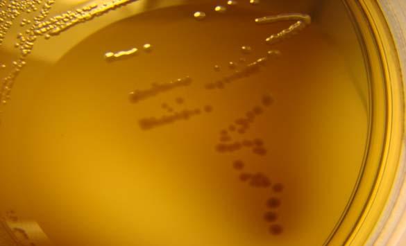 Bacteroides fragilis