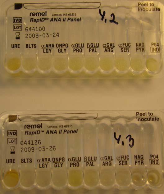 Peptostreptococcus anaerobius 4.2. B.