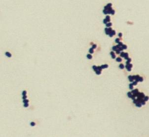 Peptostreptococcus anaerobius B.