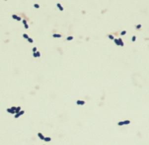 Aerobi inkubaatio, 5% CO 2, +35 C, 1 vrk.