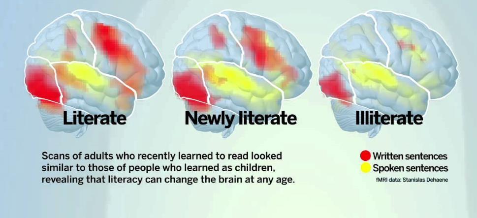 Lukemaan oppiminen muuttaa aivoja Lapsena lukemaan oppineet Aikuisena lukemaan