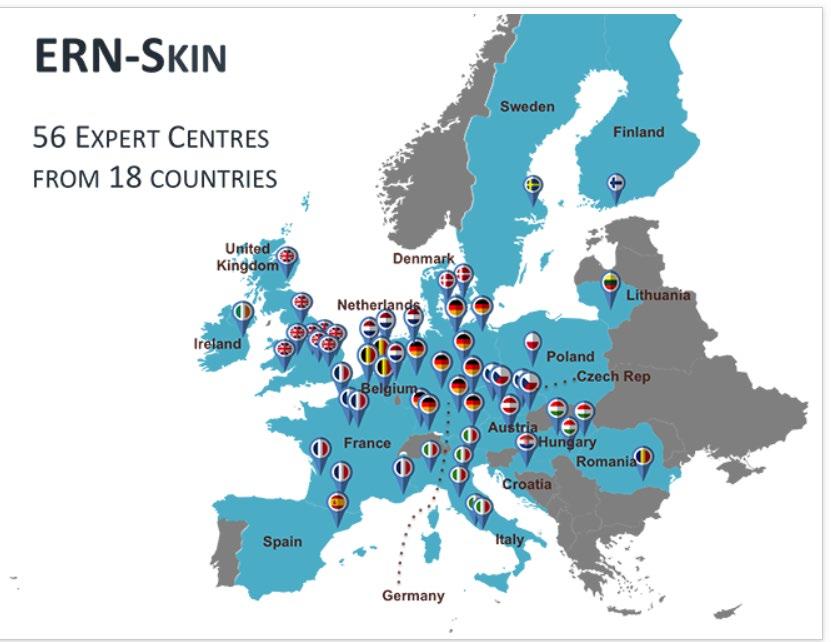 ERN ON SKIN DISORDERS = ERN SKIN Verkosto tuo yhteen johtavat asiantuntijat harvinaisisia ja vaikeissa lasten ja aikuisten ihosairauksissa Harvinaisia ja ei-diagnosoituja