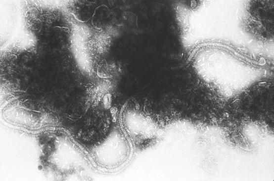 RS-VIRUS Virus eristettiin 1956 Aiheuttaa vuosittaisia epidemioita Photo CDC USA / Dr.