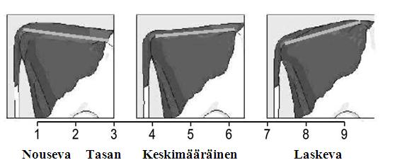 Pistearvo 5 kuvaa lantiota, jossa istuinluut ovat noin 4 cm alempana kuin lonkkakyhmyt. Jos istuinluut ovat huomattavasti alempana kuin lonkkakyhmyt, pistearvoksi annetaan 9.