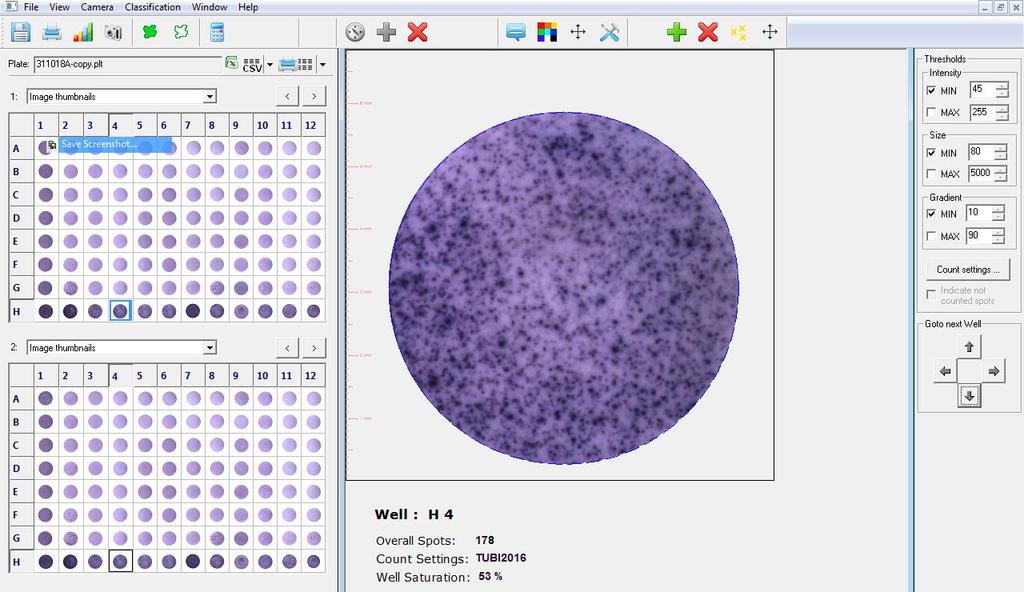 Elispot, IGRA-testi: T-Cell Xtend reagenssi; näytteentoimitusaikaikkuna muuttui 8 tunnista 32 tuntiin WBC LYM T-Cell Xtend lisätty ID PVM kellonaika T-SPOT.TB A T-SPOT.