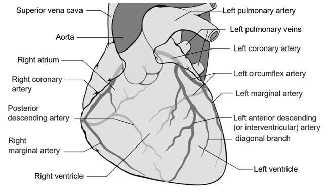 5 Figure 2. Coronary arteries (courtesy of Wikipedia.org, used under license).