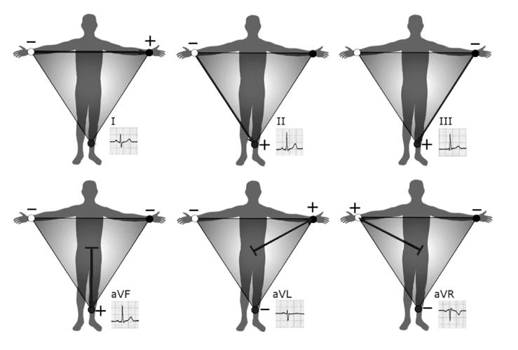 11 Figure 6. The six limb leads of the ECG. Three standard limb leads I, II and III form an imaginary triangle, called Einthoven s triangle. In addition there are three augmented leads.
