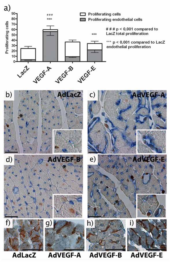 42 endothelial cells (ECs) but in the AdVEGF-B group, the percentage of proliferating ECs was only 25, with most of the proliferation being in cardiomyocytes.