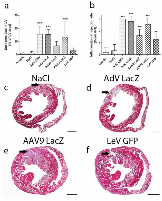 46 28 days after the gene transfer (Figure 18 c-f, arrows).