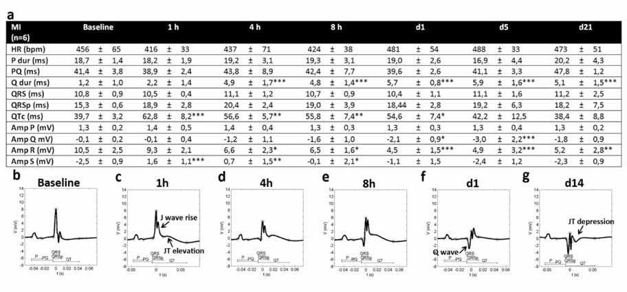 52 Figure 24. ECG changes in acute myocardial infarction caused by LAD ligation. The ECG measurements after AMI (a) and representative ECG curves (b-g).