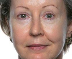 97101332 (valkoinen) 97101333 (musta) KASVOJENHOITOPÄÄ NU SKIN GALVANIC SPA SYSTEM FACIAL GELS WITH ageloc Nuoremman näköinen iho 5 minuutissa.