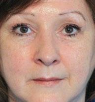 Ne hyödyntävät patentoitua ageloc -teknologiaa, joka kohdistaa tehonsa ihon ikääntymisen näkyvien merkkien alkulähteille.