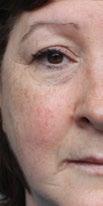 97003876 YLIVOIMAISET TULOKSET Tekemällä kasvohoidon ageloc Edition Nu Skin Galvanic Spa System II -laitteella 3 kertaa viikossa, parannat Future Serumin ihon ikääntymisen moniin näkyviin merkkeihin