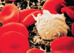Solunsalpaajahoito ja veren valkosolut Veri koostuu plasmasta, punasoluista, valkosoluista ja verihiutaleista.