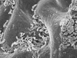 Biohiili ja mikrobit Biohiili toimii eri mikrobeille (bakteerit, sienet, sienijuuret) kasvualustana.