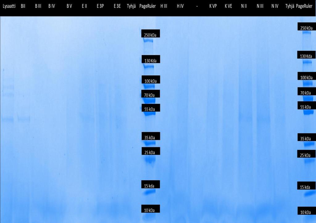 Kuva 10. SDS-PAGE-kuvat. Kaivoihin pipetoitiin 30 µl näytteitä, joissa oli 15 µl puhdistettuja näytteitä ja 15 µl 2x-näytepuskuria, jossa 0,2 M DTT. Geelinä oli Bio-Rad protean TGX-valmisgeeli.