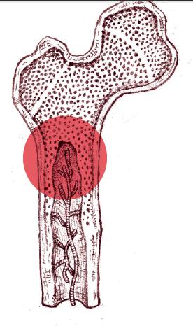 HOITAJALLE Tässä on esitetty luun kuva ja punaisella pallolla on merkitty luuydin. Aikuisella verisolut muodostuvat ja kypsyvät luuytimessä. Yksi verisolujen muoto on plasmasolu.