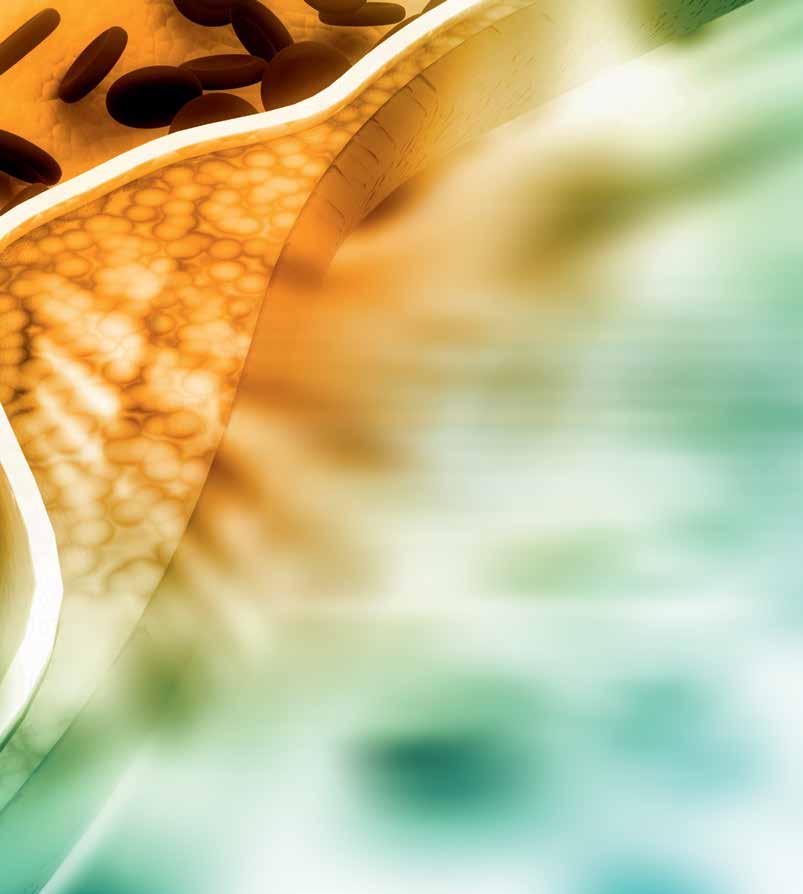 SPIROTECIN RATKAISUT LIANEROTUKSEEN Spirotech tarjoaa laajan valikoiman lianerottimia.