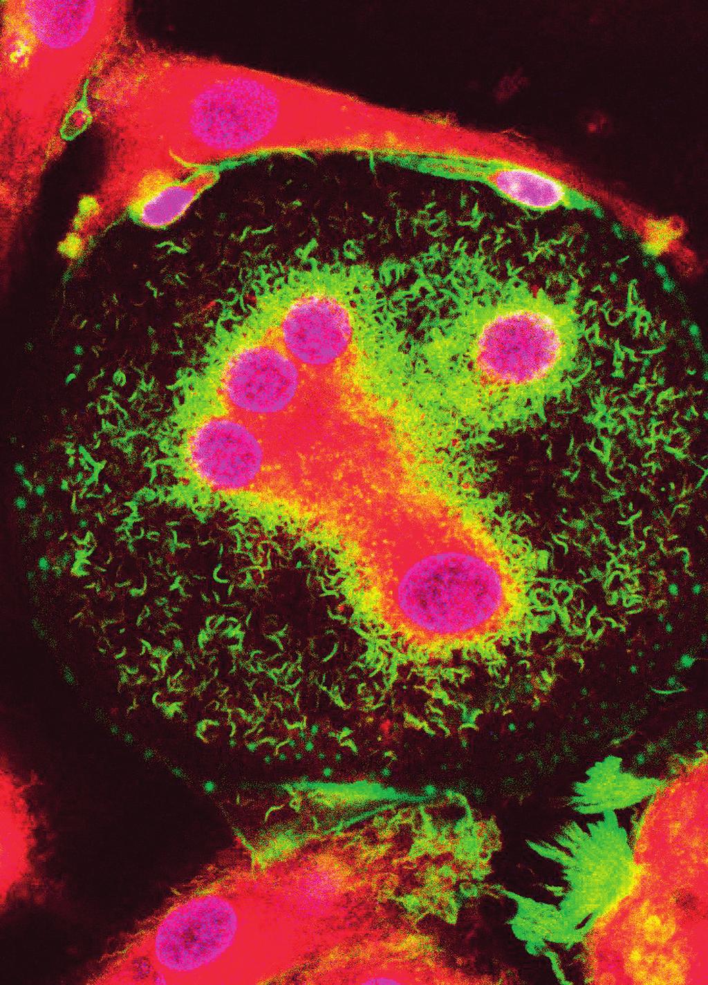 REGULATION OF SCHWANN CELLS AND OSTEOCLASTS WITH AN EMPHASIS ON NF1-DEFICIENT CELLS Paula Pennanen TURUN YLIOPISTON JULKAISUJA ANNALES UNIVERSITATIS