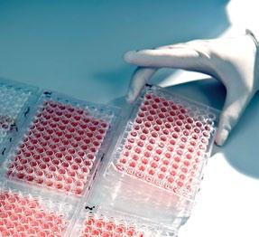 varmistamiseksi Veren-, solujen ja kudosten siirron sopivuuden tutkimus, joka luo yhteisen tieteellisen pohjan Veripalvelun laboratoriotoiminnalle Uusien soluterapioiden tutkimus niiden käyt töön