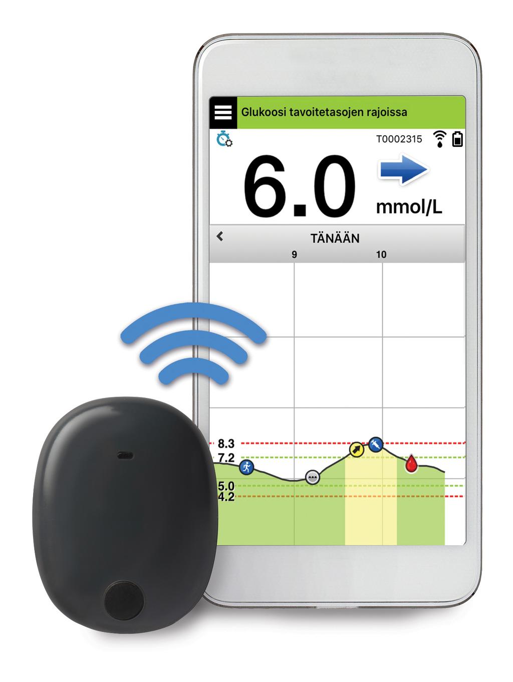 Continuous Glucose Monitoring järjestelmä Pikaopas Eversense XL CGM järjestelmä käsittää olkavarteen asetettavan sensorin, sensorin päällä käytettävän