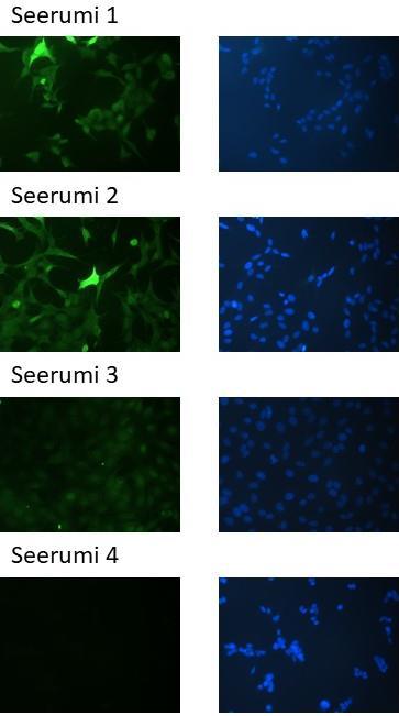 Tämän työn immunofluoresenssitutkimuksissa yksikään HA-epitoopin suhteen positiivinen solu ei ollut positiivinen TBEV-potilaiden seerumien IgG-vasta-aineiden suhteen.