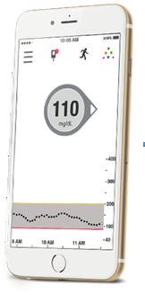 12 Kuinka liittää Dexcom (G5 Mobile/