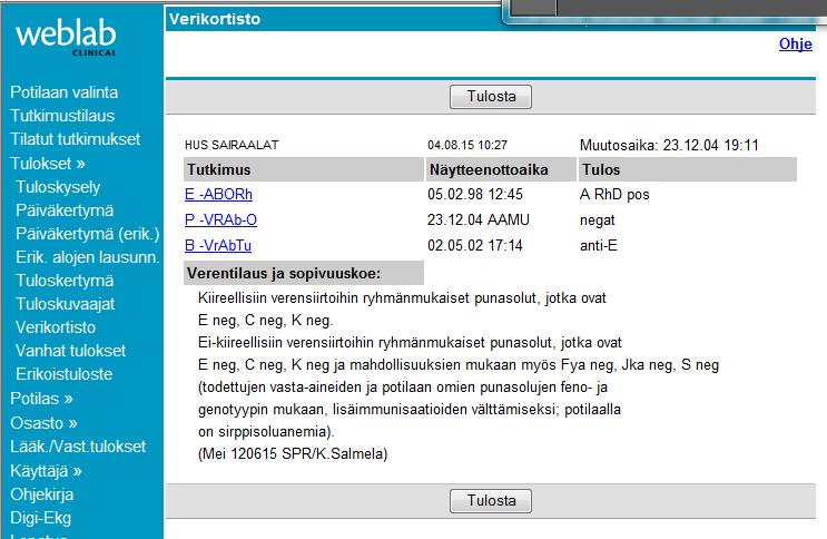 Verensiirtosuositukset sirppisoluanemiassa ja talassemioissa 20-50% punasoluvasta-aineita todetut vasta-aineet huomioidaan aina alloimmunisaation välttämiseksi