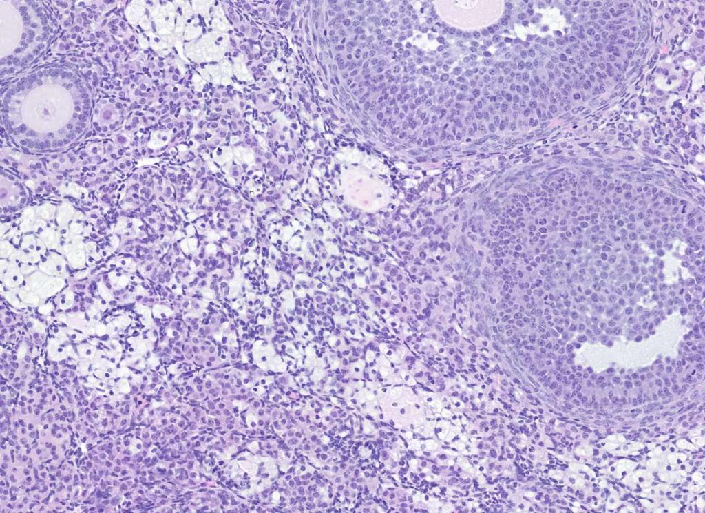 Additionally, immunohistochemical staining and qrt-pcr analysis confirmed that CYP17A1 was not upregulated in the theca cells of the Naglu-Neo females.