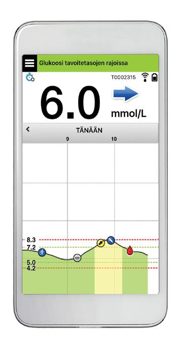 Eversense XL CGM järjestelmän osat Järjestelmä sisältää: 1) pienen sensorin, jonka terveydenhuoltopalvelun tarjoaja asettaa ihon alle, 2) sensorin päällä käytettävän, irrotettavan älylähettimen ja 3)